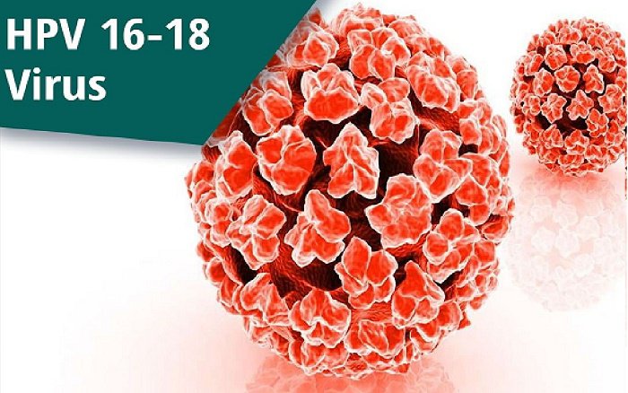 Người bệnh nhiễm phải virus HPV loại 16 và loại 18 có thể gây nên bệnh ung thư amidan
